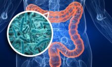 ¿Qué es la flora intestinal?