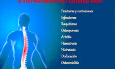 Enfermedades que afectan el sistema óseo