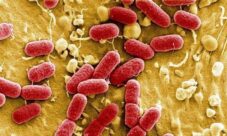 Bacterias causantes de las infecciones urinarias