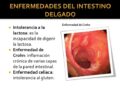 Enfermedades del intestino delgado