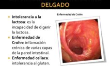 Enfermedades del intestino delgado