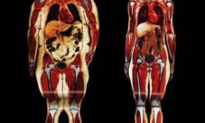 ¿Cómo afecta la obesidad al sistema óseo?
