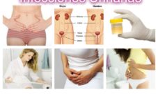 Vías de contagio de la infección urinaria