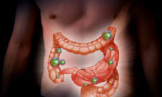 Sintomas de la flora intestinal dañada