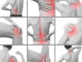 ¿Cuáles son las lesiones más comunes en los músculos?