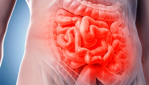 ¿Por qué se inflama el intestino delgado?