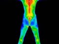 ¿Cuál es la temperatura normal en el cuerpo humano?