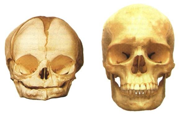 Diferencia del cráneo de un bebé y el de un adulto
