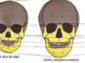¿Hasta qué edad crecen los huesos del cráneo?