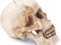 ¿Por qué se deforma el cráneo en adultos?