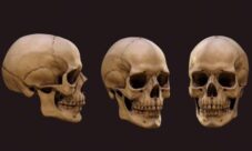 ¿Qué es el cráneo humano?